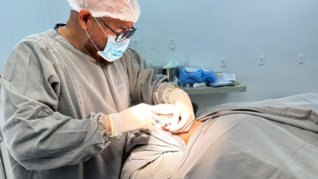 HOSPITAL REGIONAL DE AUGUSTINÓPOLIS REALIZA CIRURGIA INÉDITA REPARADORA DE OTOPLASTIA